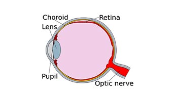 Symptoms of a retinal tear Symptoms of a retinal tear
